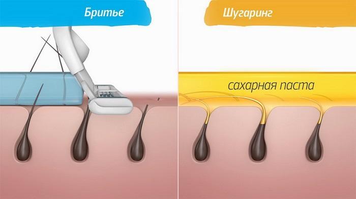 Бритье и шугаринг