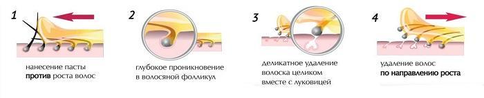 Процесс шугаринга