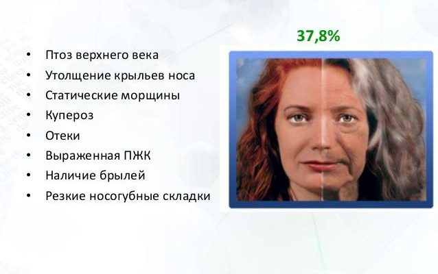 типы старения1